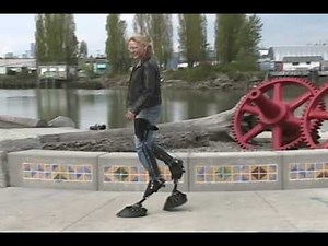 Bionic Animal Legs Are Built For Theater and/or Enchanted Woodlands