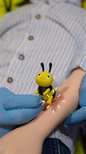 First Aid for a Severe Allergic Reaction (Bee Sting) 🐝🚑 #ambulance #paramedic #emergency #firstaid