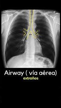 Radiografía de Tórax: Guía Estructurada para Estudiantes de Medicina