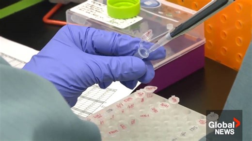 ‘More traction in other provinces’: Alberta-made blood test could improve breast cancer screening