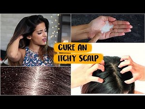6 WINTER Haircare Hacks To Get Rid Of An Itchy Scalp Naturally At Home/ Tips & Tricks