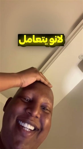 نكتة الاصلع😂