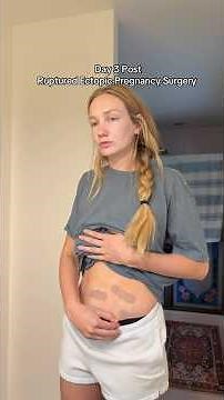 Day 3 Post Ruptured Ectopic Pregnancy Surgery