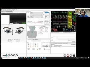 Operating LLEAP