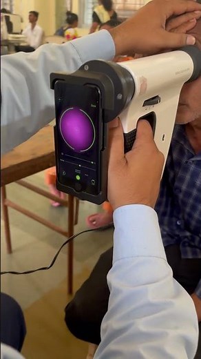 AI based Fundus camera for screening retina issues