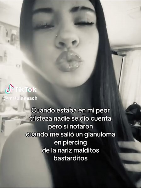 Granuloma en Piercing: Mi Peor Momento