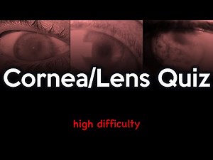 Cornea and Lens Quiz: High Difficulty