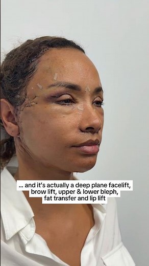 The Secret to Aging Gracefully 😱 Natural Facelift Results