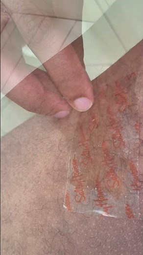 Male Brazilian Wax DIY Removal Kit