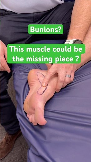 Abductor hallucis muscle: a must for bunion pain