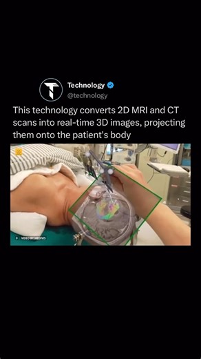 Technology on Instagram: "What technology needs to be used for ♥️ This technology converts 2D MRI and CT scans into real-time 3D images, projecting them onto the patient’s body. It utilizes augmented reality and computer vision to enhance surgical outcomes for patients while also driving cost efficiencies for medical institutions. (Via: @medivis_ar) #health #hospital #technology #reels #doctor"