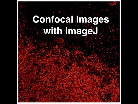 Analyzing Confocal Images with ImageJ