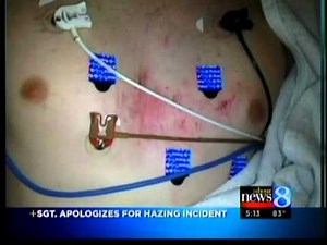 Sgt. apologizes for Army hazing incident