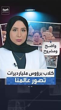 كلاب روبوتية برؤوس ماسك وزوكربيرغ وبيزوس في برلين.. كيف يعيد الذكاء الاصطناعي تصوير عالمنا؟