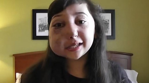 Influencer Nikki Lilly explains how life changed after rare diagnosis