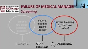 Management of GI Bleeding - An IR Perspective