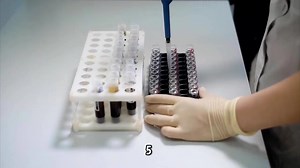 华韵生物-密度梯度离心：单个核细胞分离的有效方法及其广泛应用