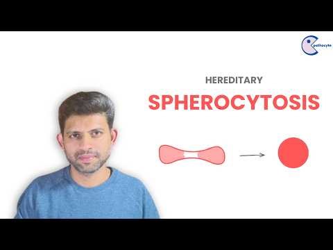 Hereditary Spherocytosis – Pathogenesis & Morphology