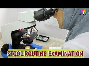 Stool Routine examination.Stool analysis in laboratory. MLT WORLD
