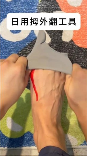 Big Solution in home treatment #relax #bunion #youtubeshorts #shortvideo