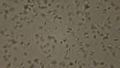 Sperm viewed under the microscope. Moving human sperm under Phase...