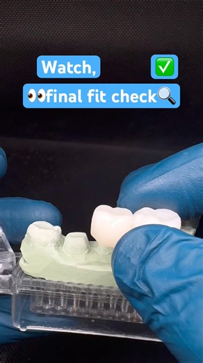 #dentallaboratory #dentist #zirconiacrown #dentalcaddesign #digitaldentistry #dentaloffice