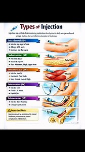 17K views · 81 reactions | Quick review about Types of Injection 類喙 #healthcare #healtheducation #medical #MedicalEducation #nursing #nurselife #nursinginformation #nursingeducation #medicalinformation #nursingstudent #injection | Ma Vickie | Facebook