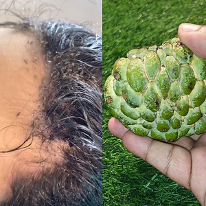 Custard Apple And Black Pepper KILL HEAD LICE & NITS OVERNIGHT #headliceremoval #nits #lice #diy #homemade #beauty #hair #haircare | Anmol Hindi