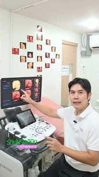 ซาวด์ 4D ตอน 30 week 👩‍⚕️🤰จะเห็นภาพเป็นยังไง ❓
