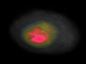 File:Isotropic-3D-Nuclear-Morphometry-of-Normal-Fibrocystic-and-Malignant-Breast-Epithelial-Cells-pone.0029230.s008.ogv - Wikimedia Commons