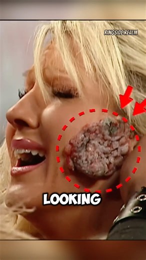 Was Jillian Hall's Face Mole Real Or Fake #wwe #romanreigns #johncena #boogeyman