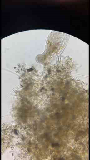 Exploring Microbes Under the Microscope