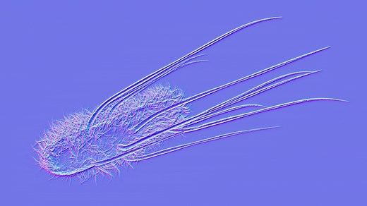 Damage from gut bacteria may play a role in the rise in colon cancer in young adults