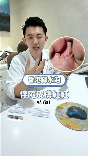 你的腳底也有水泡嗎？#汗皰疹 #香港腳 #保養 #醫美 #皮膚科 #醫師 #皮膚科學Man #陳昱璁 #skincare