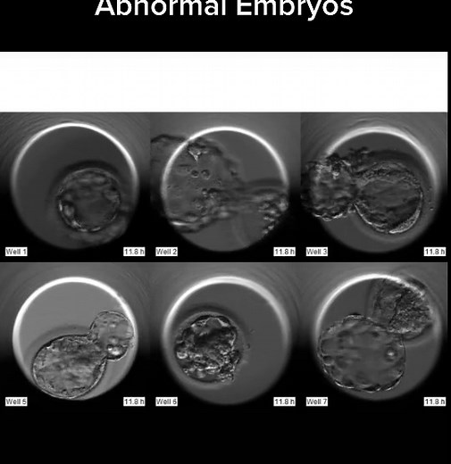 MARIA BANTI IVF على TikTok
