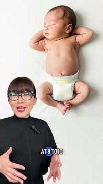 👣Why Does Your Newborn Baby's Legs Looked Bowed?😬