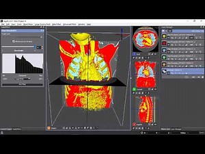 Segmentar múltiples regiones anatómicas de una sola vez con Seg3D
