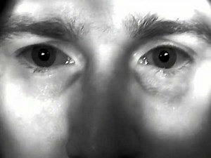 Orbicularis Myokymia