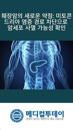 [Medical Today - Shorts News] Possibility of Cancer Cell Death Confirmed by Blocking Mitochondria...