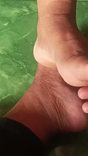 How to massage the feet of a stroke #shorts #massage #Street therapist