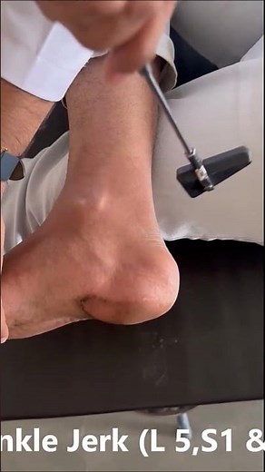 Ankle Jerk by Dr MP
