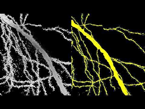 AI Tool Reveals Complete 3D Architecture of Brain Cells