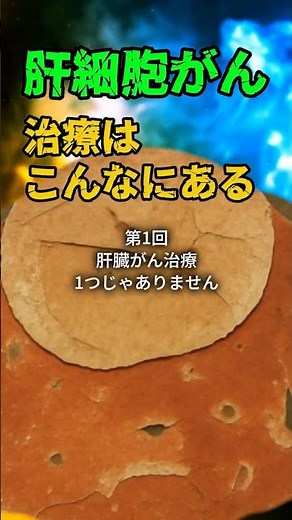 肝細胞がん、治療はこんなにある ①肝臓がんの治療、1つじゃありません #肝細胞癌 #肝臓がん #がん治療 #ラジオ波焼灼術 #TACE #化学療法 #医療解説 #shorts