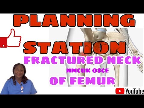 Planning Fracture Neck of Femur scenario (Explained!) #nmcuk #nursing #planning #osce #new