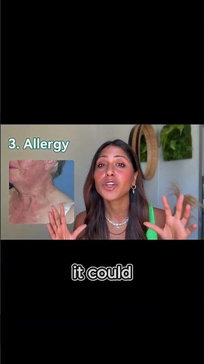 What If Your Rash Isn’t What You Think? | Doctor Explains