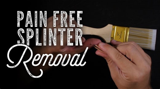 Remove splinters fast and painlessly using simple methods