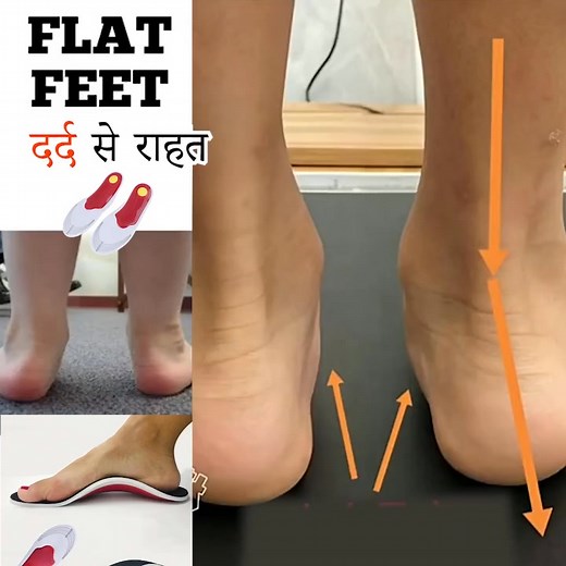 😍 This Flat Foot Insoles are your solution to end foot pain and enjoy every step. Podiatrist approved for all-day relief 😍 ✅ Pain Relief for Feet & Knees ✅ Durable Arch Support ✅ Posture & Alignment Support ✅ Flat Foot Correction 🔥 Limited Time Offer - Order Now 🔥 https://gogoband.store/products/flat-foot-correction-insoles | Gogoband