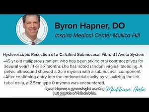 Byron Hapner, DO - Hysteroscopic Resection of a Calcified Submucosal Fibroid | Aveta System