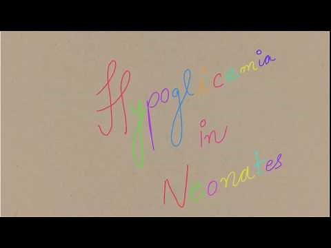 Neonatal Hypoglycemia- symptoms and management (latest Guidelines)