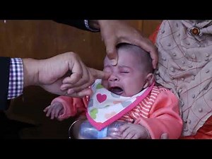 Tear Duct Massage in urdu #prevention